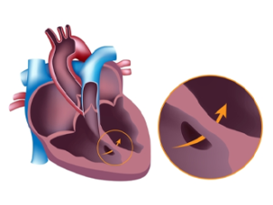 Best Heart Specialist in Indore | Get Experts Now