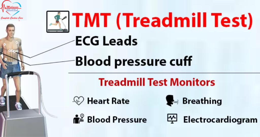 TMT Test - Cardiologist in Indore