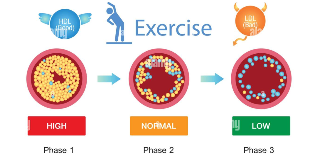 Risk Factors of Cholesterol - Best Cardiologist