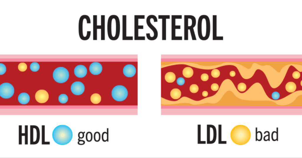 Types of Cholesterol - Best Cardiologist