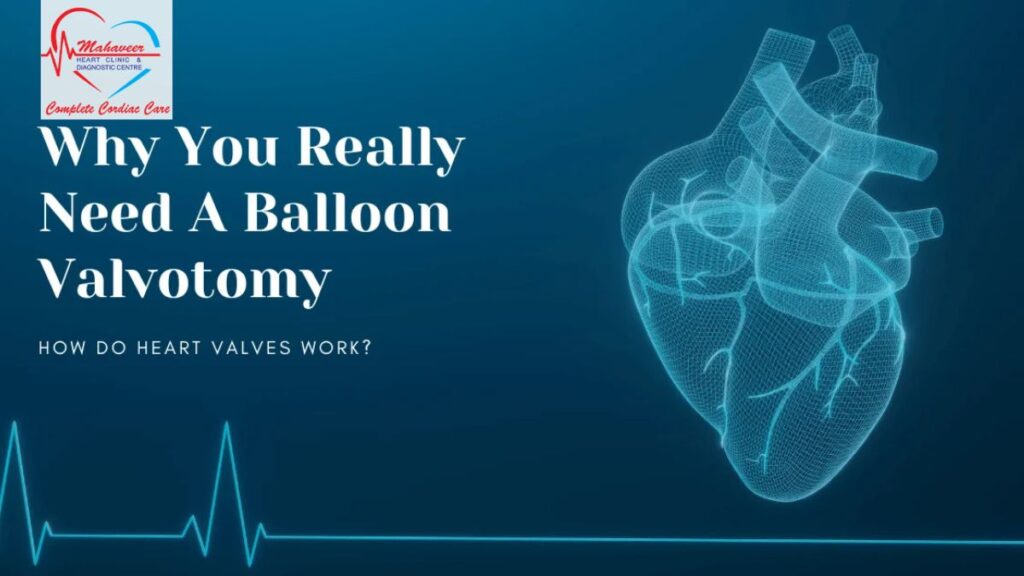 Balloon-Valvotomy-Dr Rakesh Jain-Indore cardiologist