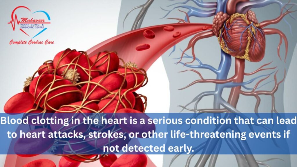Blood Clots In Heart by Dr Rakesh jain - Heart Surgery in Indore