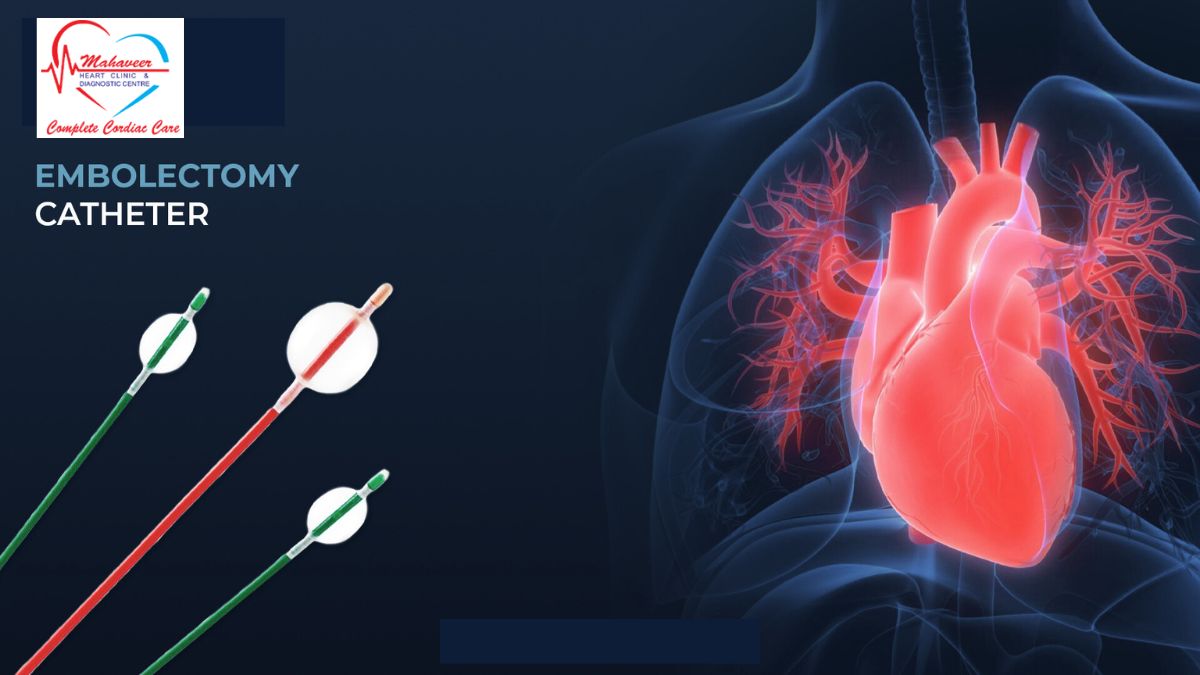 Embolectomy explained by Dr Rakesh Jain, a leading Heart Specialist In Indore