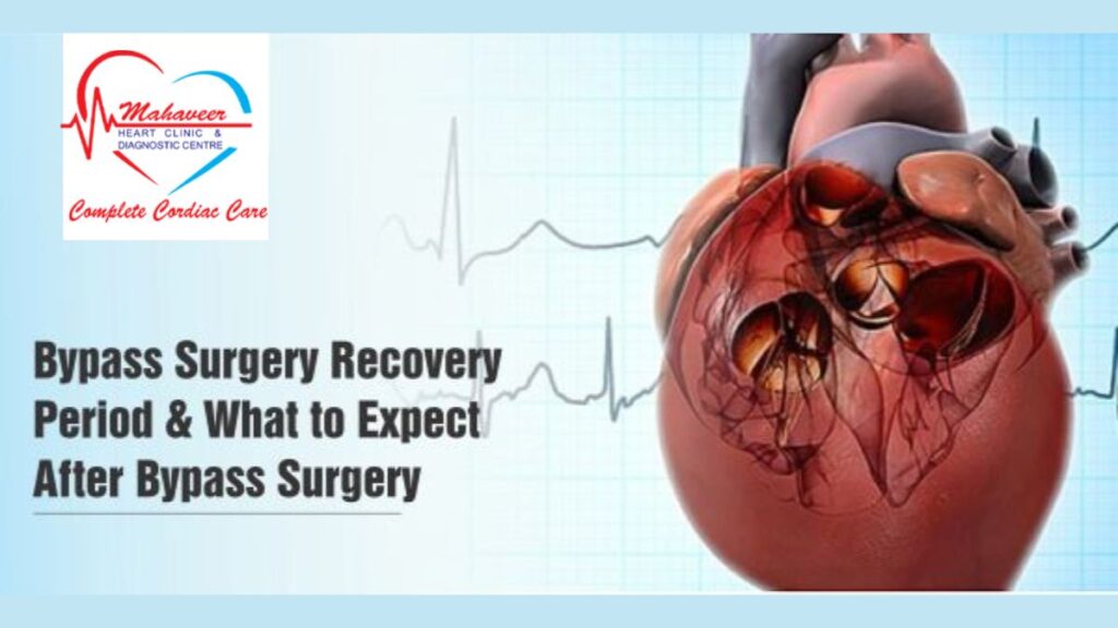 Heart Bypass Surgery - Dr Rakesh Jain - Cardiologist In Indore