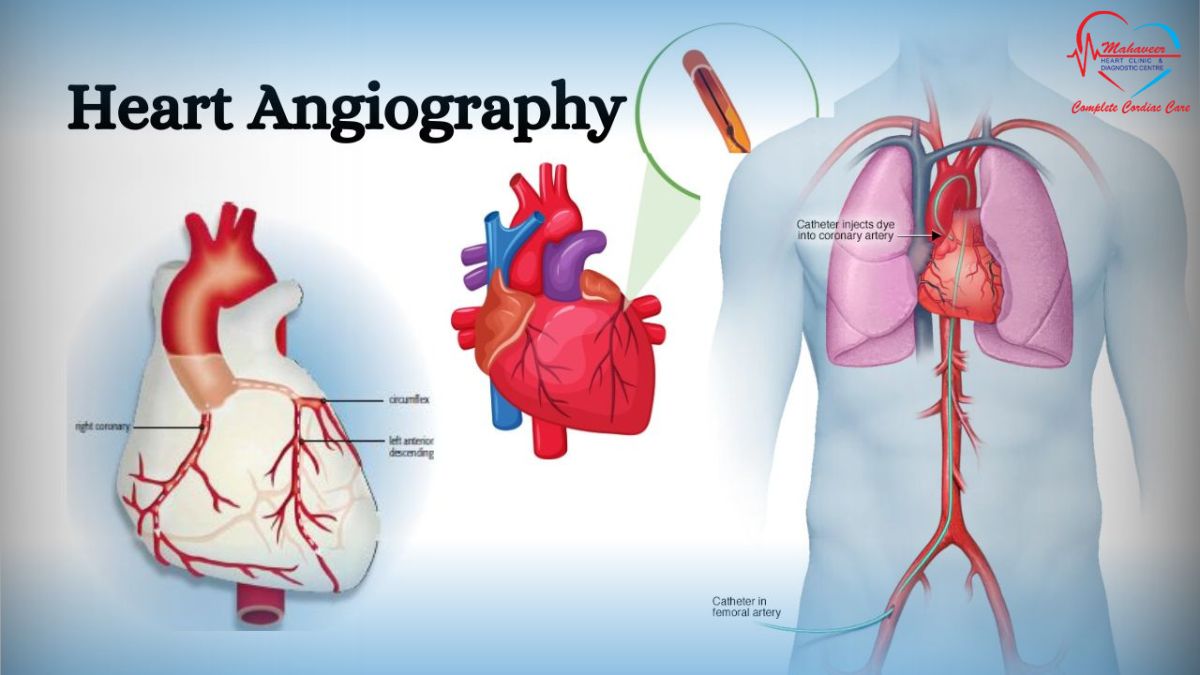 Angiography - Dr Rakesh Jain - Heart Specialist Doctor
