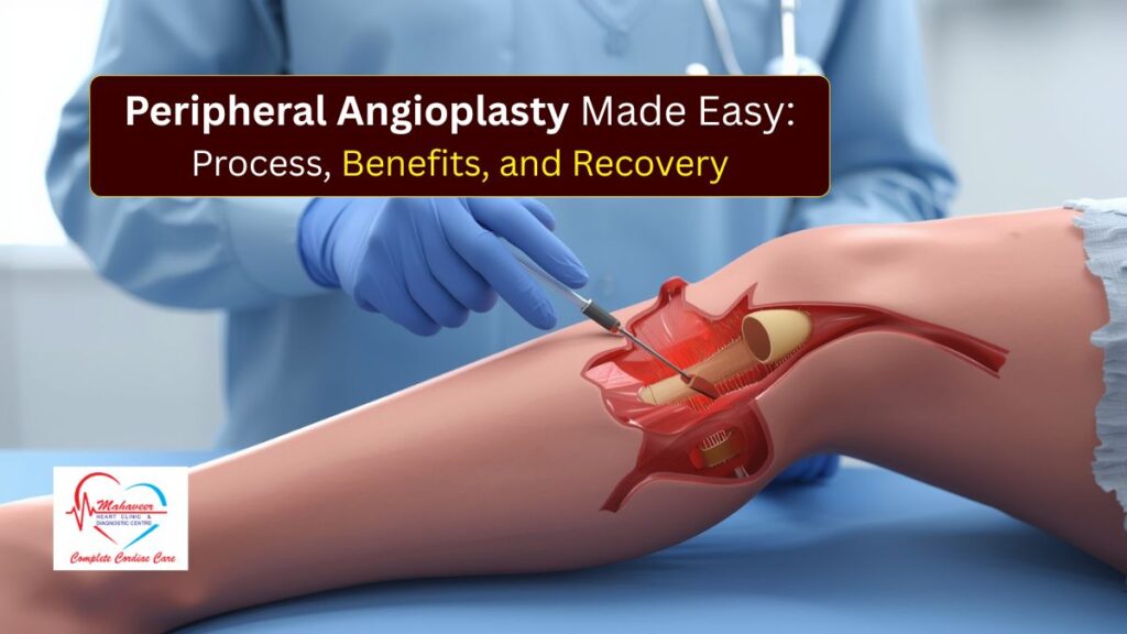 Peripheral Angioplasty Made Easy Process, Benefits, and Recovery - Dr. Rakesh jain Cardiologist in Indore